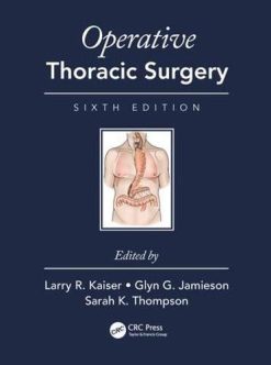 Operative Thoracic Surgery, Sixth Edition (EPUB)