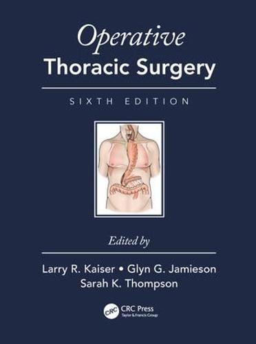 Operative Thoracic Surgery, Sixth Edition (PDF)