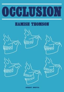 Occlusion  (Original PDF from Publisher)