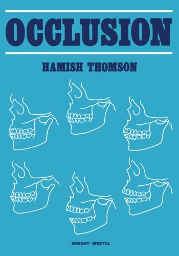 Occlusion (Original PDF from Publisher)