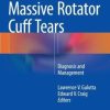 Massive Rotator Cuff Tears: Diagnosis and Management