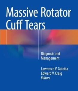 Massive Rotator Cuff Tears: Diagnosis and Management