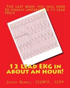 12 Lead EKG in about an Hour! (EPUB)