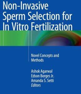 Non-Invasive Sperm Selection for In Vitro Fertilization: Novel Concepts and Methods