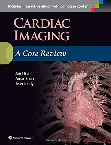 Cardiac Imaging: A Core Review (EPUB)