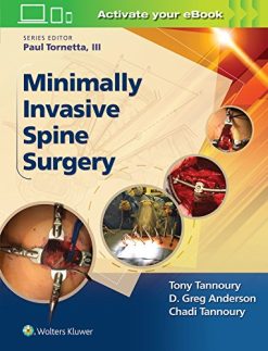 Minimally Invasive Spine Surgery (Epub)
