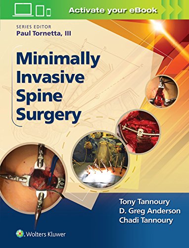 Minimally Invasive Spine Surgery (Epub)