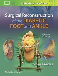 Surgical Reconstruction of the Diabetic Foot and Ankle, 2nd Edition (EPUB)