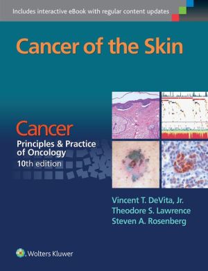 Cancer of the Skin: A Derivative of Cancer: Principles & Practice of Oncology, 10th Edition (EPUB)