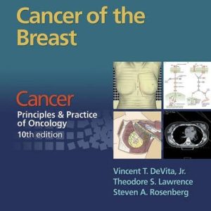 Cancer: Principles & Practice of Oncology: Cancer of the Breast (EPUB)