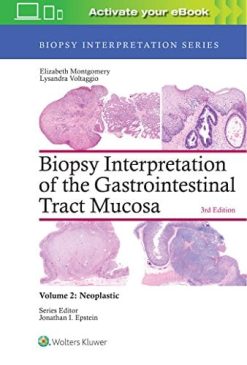 Biopsy Interpretation of the Gastrointestinal Tract Mucosa: Volume 2: Neoplastic (Biopsy Interpretation Series), 3rd Edition (EPUB)