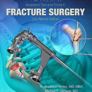 Harborview Illustrated Tips and Tricks in Fracture Surgery, 2nd Edition (ePUB)