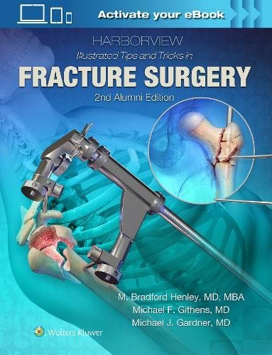 Harborview Illustrated Tips and Tricks in Fracture Surgery, 2nd Edition (ePUB)
