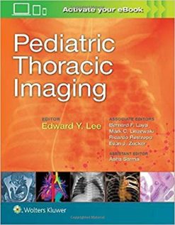 Pediatric Thoracic Imaging (ePUB)