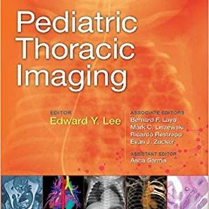 Pediatric Thoracic Imaging (ePUB)