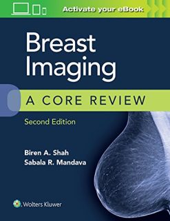 Breast Imaging: A Core Review, 2nd Edition (EPUB)
