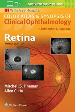 Retina (Color Atlas and Synopsis of Clinical Ophthalmology) (ePUB)