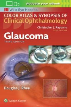 Glaucoma (Color Atlas & Synopsis of Clinical Ophthalmology), 3rd edition (ePUB)
