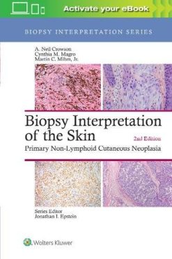 Biopsy Interpretation of the Skin: Primary Non-Lymphoid Cutaneous Neoplasia, 2nd Edition (Biopsy Interpretation Series) (EPUB)
