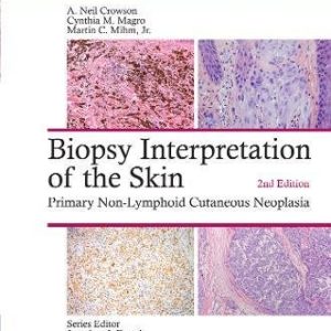 Biopsy Interpretation of the Skin: Primary Non-Lymphoid Cutaneous Neoplasia, 2nd Edition (Biopsy Interpretation Series) (EPUB)
