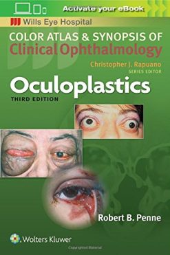 Oculoplastics (Color Atlas and Synopsis of Clinical Ophthalmology) (ePUB)