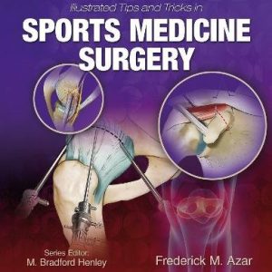 Illustrated Tips and Tricks in Sports Medicine Surgery (ePUB)