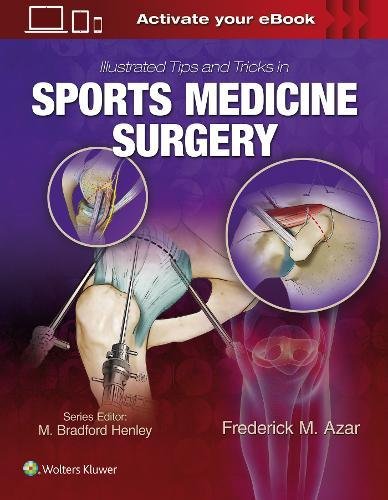 Illustrated Tips and Tricks in Sports Medicine Surgery (ePUB)