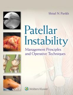 Patellar Instability (EPUB)