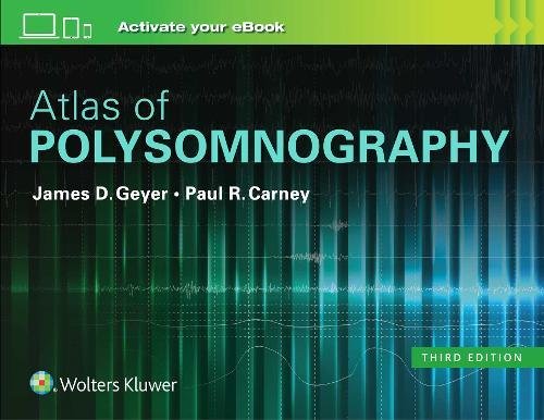 Atlas of Polysomnography (EPUB)