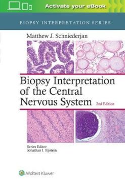 Biopsy Interpretation of the Central Nervous System, 2nd Edition (EPUB)