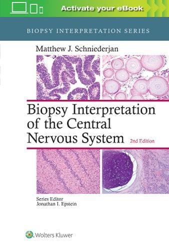 Biopsy Interpretation of the Central Nervous System, 2nd Edition (EPUB)