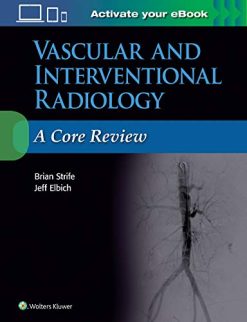 Vascular and Interventional Radiology: A Core Review (ePub)