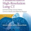 Fundamentals of High-Resolution Lung CT: Common Findings, Common Patterns, Common Diseases and Differential Diagnosis, 2ed (ePUB)