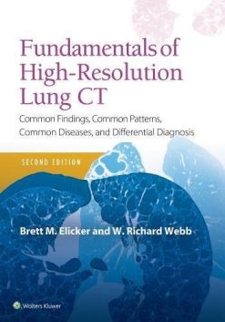 Fundamentals of High-Resolution Lung CT: Common Findings, Common Patterns, Common Diseases and Differential Diagnosis, 2ed (ePUB)