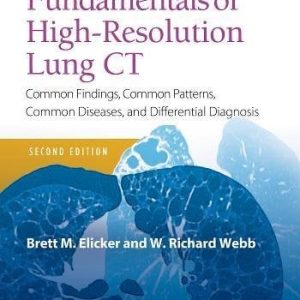 Fundamentals of High-Resolution Lung CT: Common Findings, Common Patterns, Common Diseases and Differential Diagnosis, 2ed (ePUB)