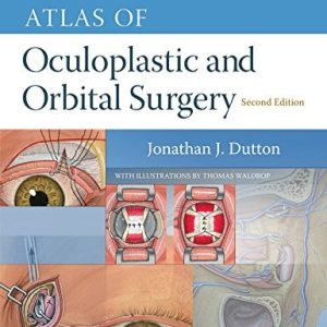 Atlas of Oculoplastic and Orbital Surgery, 2nd Edition (ePUB)