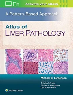 Atlas of Liver Pathology: A Pattern-Based Approach (ePub+Converted PDF)