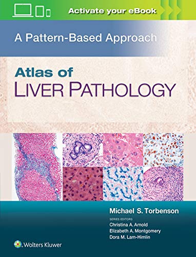 Atlas of Liver Pathology: A Pattern-Based Approach (ePub+Converted PDF)