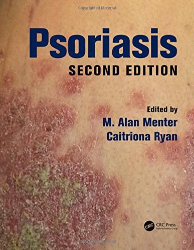 Psoriasis, Second Edition (EPUB)