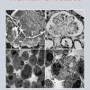 Glycobiology and Human Diseases