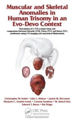 Muscular and Skeletal Anomalies in Human Trisomy in an Evo-Devo Context: Description of a T18 Cyclopic Fetus and Comparison Between Edwards (T18), Patau (T13) and Down (T21) Syndromes Using 3-D Imaging and Anatomical Illustrations