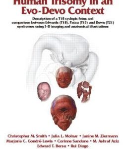 Muscular and Skeletal Anomalies in Human Trisomy in an Evo-Devo Context: Description of a T18 Cyclopic Fetus and Comparison Between Edwards (T18), Patau (T13) and Down (T21) Syndromes Using 3-D Imaging and Anatomical Illustrations