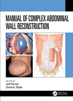 Manual of Complex Abdominal Wall Reconstruction (Original PDF from Publisher)