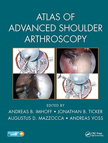 Atlas of Advanced Shoulder Arthroscopy (EPUB)