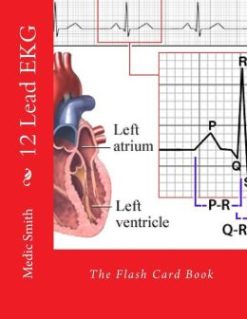 12 Lead EKG: The Flash Card Book (EPUB)