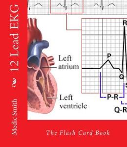 12 Lead EKG: The Flash Card Book (EPUB)