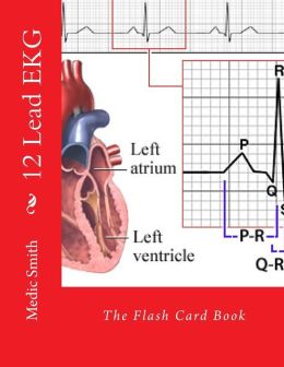 12 Lead EKG: The Flash Card Book (EPUB)