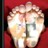 Diabetic Foot Management at the Primary Care Level (Original PDF from Publisher)