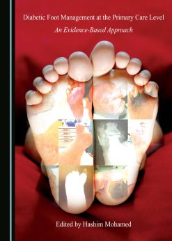 Diabetic Foot Management at the Primary Care Level (Original PDF from Publisher)