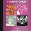 Hereditary and Familial Colorectal Cancer (Original PDF from Publisher)